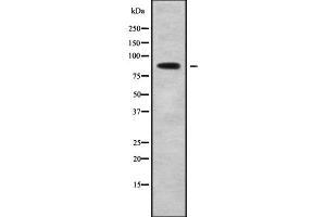 Western blot analysis of PLA2G4B using K562 whole cell lysates (PLA2G4B antibody  (C-Term))