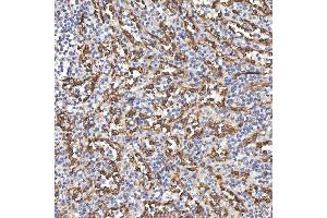 IHC analysis of TP53I13 using anti-TP53I13 antibody (ABIN7601220). (TP53I13 antibody  (AA 30-365))