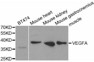 Western blot analysis of extracts of various cell lines, using VEGFA antibody (ABIN5973338) at 1/1000 dilution. (VEGFA antibody)