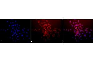 Immunocytochemistry/Immunofluorescence analysis using Rabbit Anti-SOD (Mn) Polyclonal Antibody (ABIN361655 and ABIN361656). (SOD2 antibody)