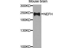 Western blot analysis of extracts of mouse brain, using NEFH antibody (ABIN5974903) at 1/1000 dilution.