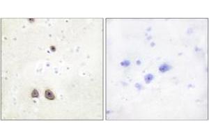 Immunohistochemistry analysis of paraffin-embedded human brain tissue, using Caper Antibody. (RBM39 antibody  (AA 171-220))