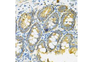 Immunohistochemistry of paraffin-embedded rat intestine using HSP90AB1 Antibody. (HSP90AB1 antibody  (AA 1-300))