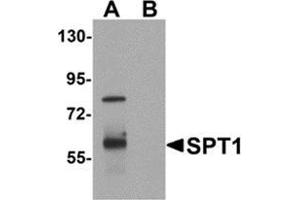 Western blot analysis of VASH1 in human brain tissue lysate with VASH1 antibody at 1 μg/ml in (A) the absence and (B) the presence of blocking peptide.