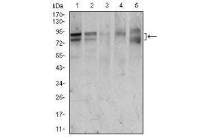 Image no. 4 for anti-Forkhead Box P1 (FOXP1) antibody (ABIN1491561) (FOXP1 antibody)