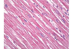 Anti-TPM3 antibody IHC of human heart. (TPM3 antibody  (AA 1-249))