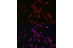 Immunofluorescence analysis of PC-12 cells using MR1 Rabbit pAb (ABIN6131925, ABIN6143983, ABIN6143984 and ABIN6224070) at dilution of 1:100 (40x lens). (MR1 antibody  (AA 20-260))