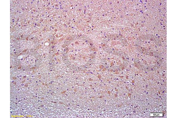 CD90 antibody  (AA 31-120)