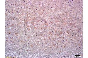 Formalin-fixed and paraffin embedded rat brain tissue labeled with Anti-Thy-1/CD90/ Thy1. (CD90 antibody  (AA 31-120))