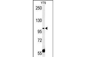 Western blot analysis in Y79 cell line lysates (35ug/lane). (CCDC146 antibody  (N-Term))