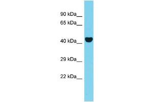 Host: Rabbit Target Name: AAR2 Sample Type: 721_B Whole Cell lysates Antibody Dilution: 1. (C20orf4 antibody  (N-Term))