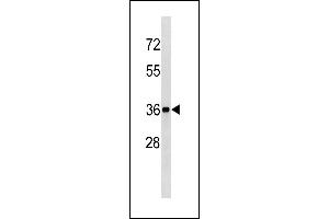 BLVRA Antibody (Center Y83) (ABIN1881115 and ABIN2843340) western blot analysis in mouse kidney tissue lysates (35 μg/lane). (Biliverdin Reductase antibody  (AA 61-89))