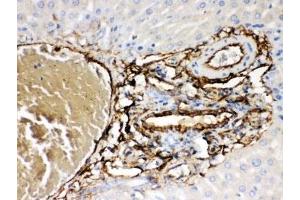 Immunohistochemistry (IHC) image for anti-ATP-Binding Cassette, Sub-Family B (MDR/TAP), Member 4 (ABCB4) (AA 601-720) antibody (ABIN3028483)
