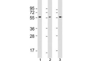 Western blot testing of 1) human MCF7, 2) human Jurkat and 3) rat PC-12 cell lysate with AKT2 antibody at 1:2000. (AKT2 antibody  (AA 272-481))