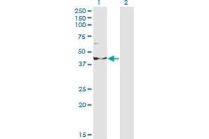 Western Blot analysis of INPP1 expression in transfected 293T cell line by INPP1 monoclonal antibody (M14), clone 1A6. (INPP1 antibody  (AA 1-399))