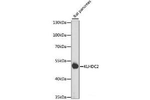 Western blot analysis of extracts of Rat pancreas using KLHDC2 Polyclonal Antibody at dilution of 1:1000.