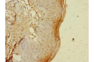 Immunohistochemistry of paraffin-embedded human skin tissue using ABIN7172192 at dilution of 1:100 (TIGD4 antibody  (AA 301-512))