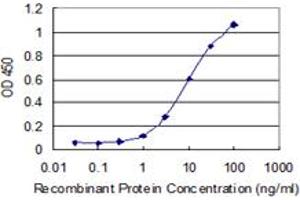 Detection limit for recombinant GST tagged NEB is 0. (Nebulin antibody  (AA 2108-2217))