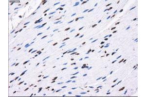 Image no. 1 for anti-Replication Protein A2, 32kDa (RPA2) antibody (ABIN1500736) (RPA2 antibody)