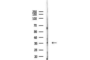 anti-Cyclin-Dependent Kinase 6 (CDK6) (N-Term) antibody
