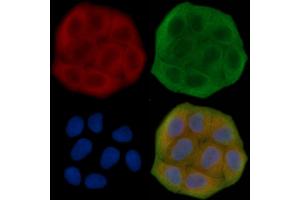 ABIN7095684 and ABIN7099746 staining Hela cells(30 min of UV treatment) by IF/ICC. (KLHL26 antibody)