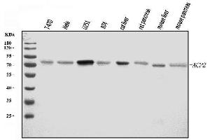 Western blot analysis of ACP2 using anti-ACP2 antibody (ABIN7603192).