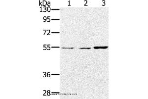 Western blot analysis of Lovo, hela and SKOV3 cell, using SESN2 Polyclonal Antibody at dilution of 1:300 (Sestrin 2 antibody)