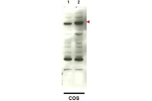 Image no. 1 for anti-SMAD Family Member 4 (SMAD4) (C-Term) antibody (ABIN401410)