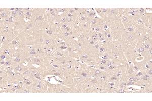 Immunohistochemistry (IHC) image for anti-Annexin A5 (ANXA5) (AA 1-320) antibody (ABIN7425791)