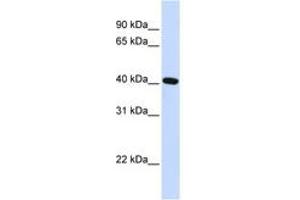 Image no. 1 for anti-Sirtuin 4 (SIRT4) (AA 36-85) antibody (ABIN6742176) (SIRT4 antibody  (AA 36-85))