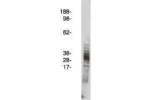 Image no. 1 for anti-Arachidonate 5-Lipoxygenase-Activating Protein (ALOX5AP) antibody (ABIN265257) (ALOX5AP antibody)