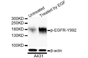 Western blot analysis of extracts of A-431 cells, using Phospho-EGFR-Y992 antibody. (EGFR antibody  (pTyr992))