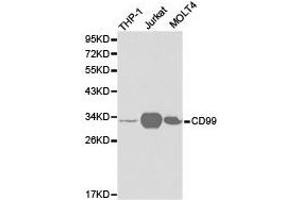Western Blotting (WB) image for anti-CD99 (CD99) antibody (ABIN1871666) (CD99 antibody)