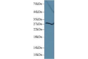 Western Blotting (WB) image for anti-Deiodinase, Iodothyronine, Type III (DIO3) (AA 37-169) antibody (ABIN7436198)