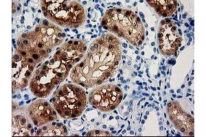 Image no. 2 for anti-Aminoacylase 3 (ACY3) antibody (ABIN1496465) (Aminoacylase 3 antibody)