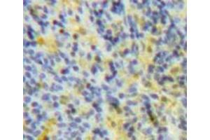 Used in DAB staining on fromalin fixed paraffin-embedded Spleen tissue (SOCS3 antibody  (AA 1-225))