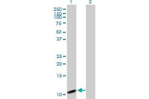 COX7A2L Antikörper  (AA 1-114)
