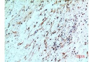 Immunohistochemistry (IHC) analysis of paraffin-embedded Human Brain, antibody was diluted at 1:100. (CXCR2 antibody  (N-Term))