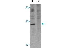 Western blot analysis of EL4 cells with TSPAN9 polyclonal antibody  at 1 ug/mL in (Lane 1) the absence and (Lane 2) the presence of blocking peptide. (Tetraspanin 9 antibody)