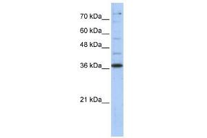 GAPDH antibody used at 1 ug/ml to detect target protein. (GAPDH antibody  (Middle Region))