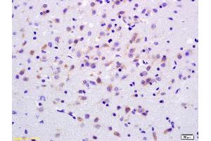 Formalin-fixed and paraffin embedded rat brain labeled with Anti-ADCY7 Polyclonal Antibody, Unconjugated (ABIN751213) at 1:200 followed by conjugation to the secondary antibody and DAB staining. (ADCY7 antibody  (AA 901-1080))