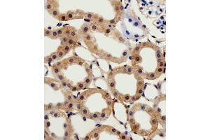 Immunohistochemical analysis of paraffin-embedded R. (CSNK2A1/CK II alpha antibody  (AA 250-284))