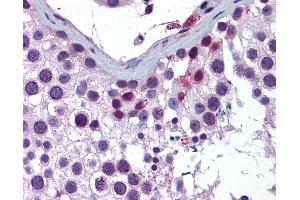 Anti-ING4 antibody IHC of human testis. (ING4 antibody  (AA 110-159))