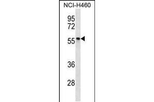 Western blot analysis in NCI-H460 cell line lysates (35ug/lane). (PHAX antibody  (C-Term))