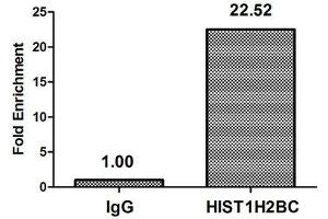 Chromatin Immunoprecipitation Hela (10 6 , treated with 30 mM sodium butyrate for 4h) were treated with Micrococcal Nuclease, sonicated, and immunoprecipitated with 5 μg anti-HIST1H2BC (ABIN7139155) or a control normal rabbit IgG. (Histone H2B antibody  (acLys120))