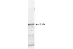 Image no. 1 for anti-3-phosphoinositide Dependent Protein Kinase-1 (PDPK1) (AA 301-312) antibody (ABIN199938) (PDPK1 antibody  (AA 301-312))