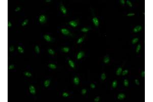 Immunofluorescence staining of Hela Cells with ABIN7127571 at 1:50, counter-stained with DAPI. (Recombinant Interleukin enhancer-binding factor 3 (ILF3) antibody)