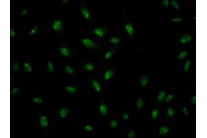 Immunofluorescence staining of Hela Cells with ABIN7127571 at 1:50, counter-stained with DAPI. (Recombinant Interleukin enhancer-binding factor 3 (ILF3) antibody)