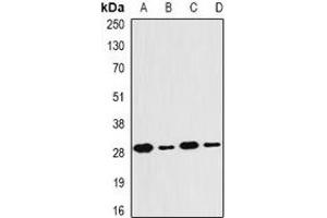 Western blot analysis of PSMB4 expression in MCF7 (A), SKOV3 (B), mouse thymus (C), mouse liver (D) whole cell lysates. (PSMB4 antibody)