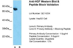 Host: Rabbit  Target Name: HGF  Sample Tissue: Human HepG2 cell  Lane A:  Primary Antibody Lane B:  Primary Antibody + Blocking Peptide Primary Antibody Concentration: 1 µg/mL Peptide Concentration: 5.